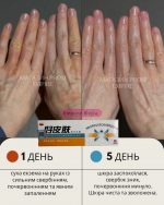 Травяной крем «Чистая кожа» (HAOPIFUCAOBENRUGAO) против псориаза, экземы. Лечение дерматита без гормональных препаратов. Экзема ле