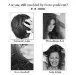 Травяной шампунь Zudaifu 120 мл, лечение экземы, дерматита, противогрибковой инфекции, шампунь от перхоти — изображение 6