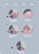Беспроводной ирригатор LP221 для чистки зубов и полости рта/10 уровней давления/6 насадок/ УФ / OLED-дисплей,335 мл. — изображение 8